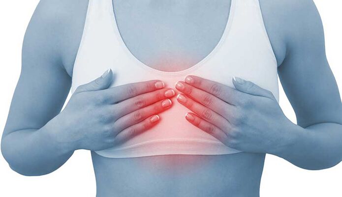 La douleur pour la chondose mammaire peut imiter la douleur cardiaque