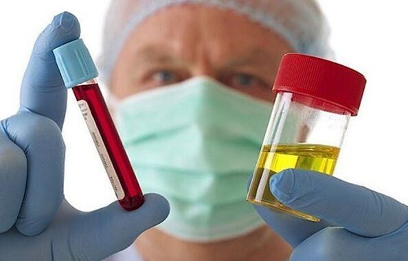 Façons de diagnostiquer l'ostéochondrose de la colonne cervicale